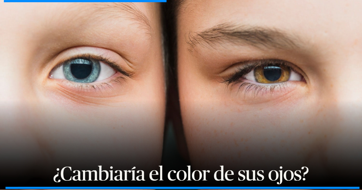 ¿se Puede Cambiar El Color De Los Ojos Acá Le Contamos Si Es Mito O Realidad El Nuevo Díaemk 2660